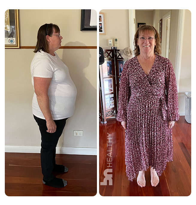 Vitamins for Hair Loss & Malnutrition Hair Supplements BNH